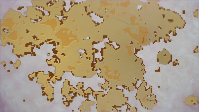 シミ・くすみ解析