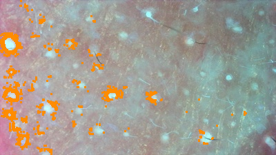 ポルフィリン解析